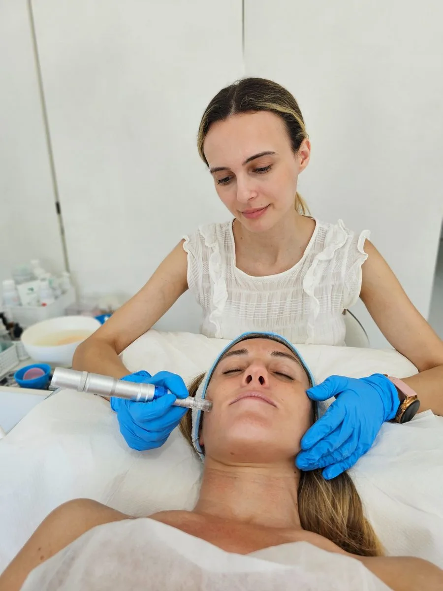 Limpieza + Microneedling